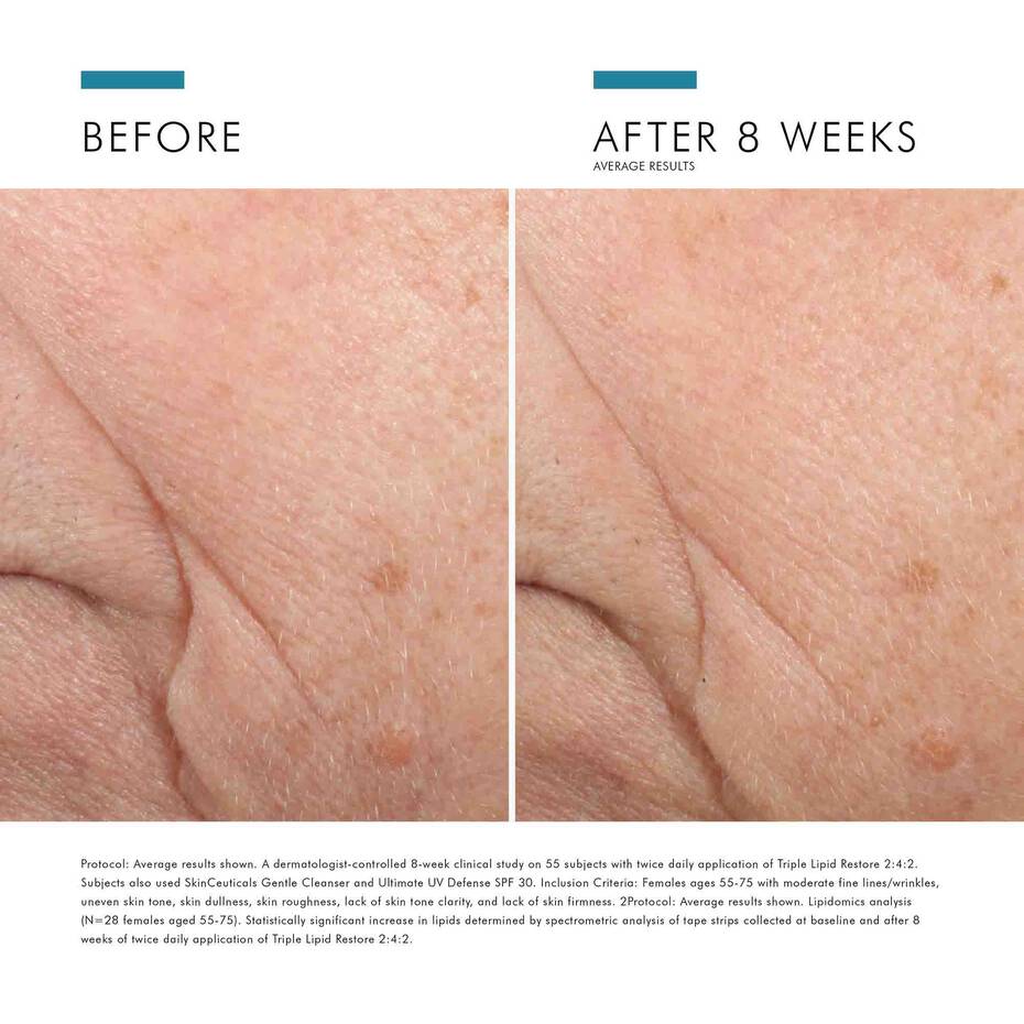 Triple Lipid Restore