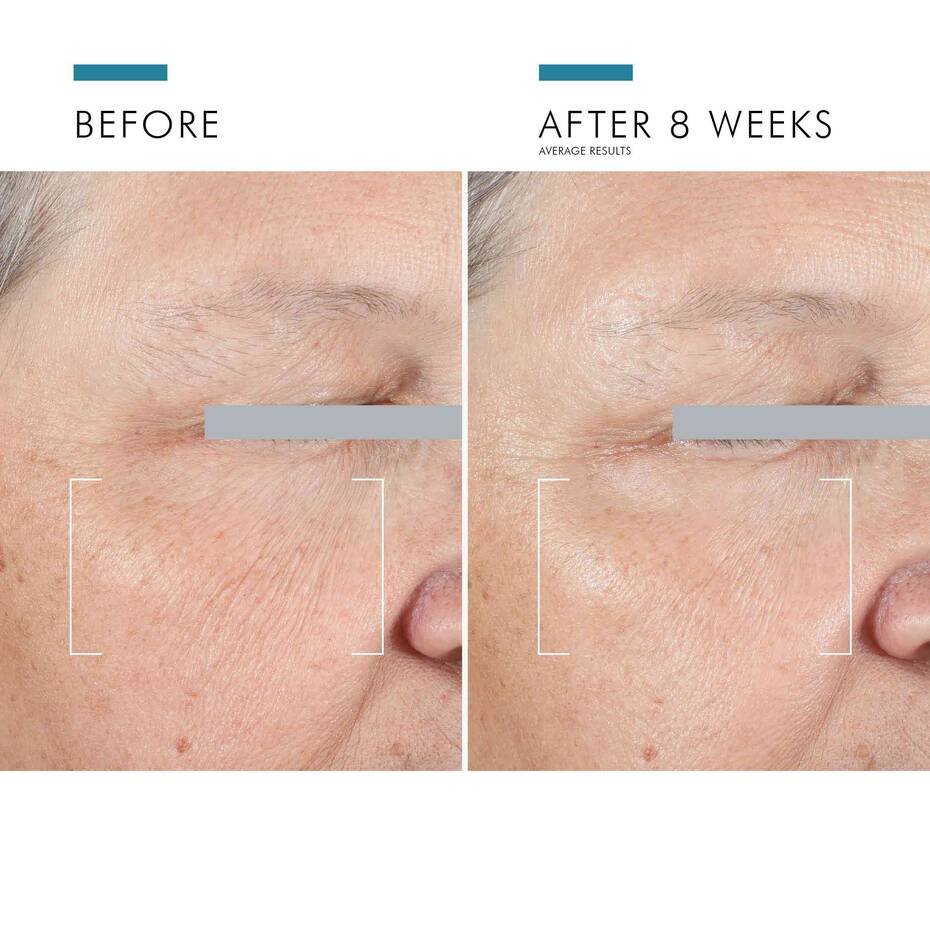 A.G.E Advanced Eye