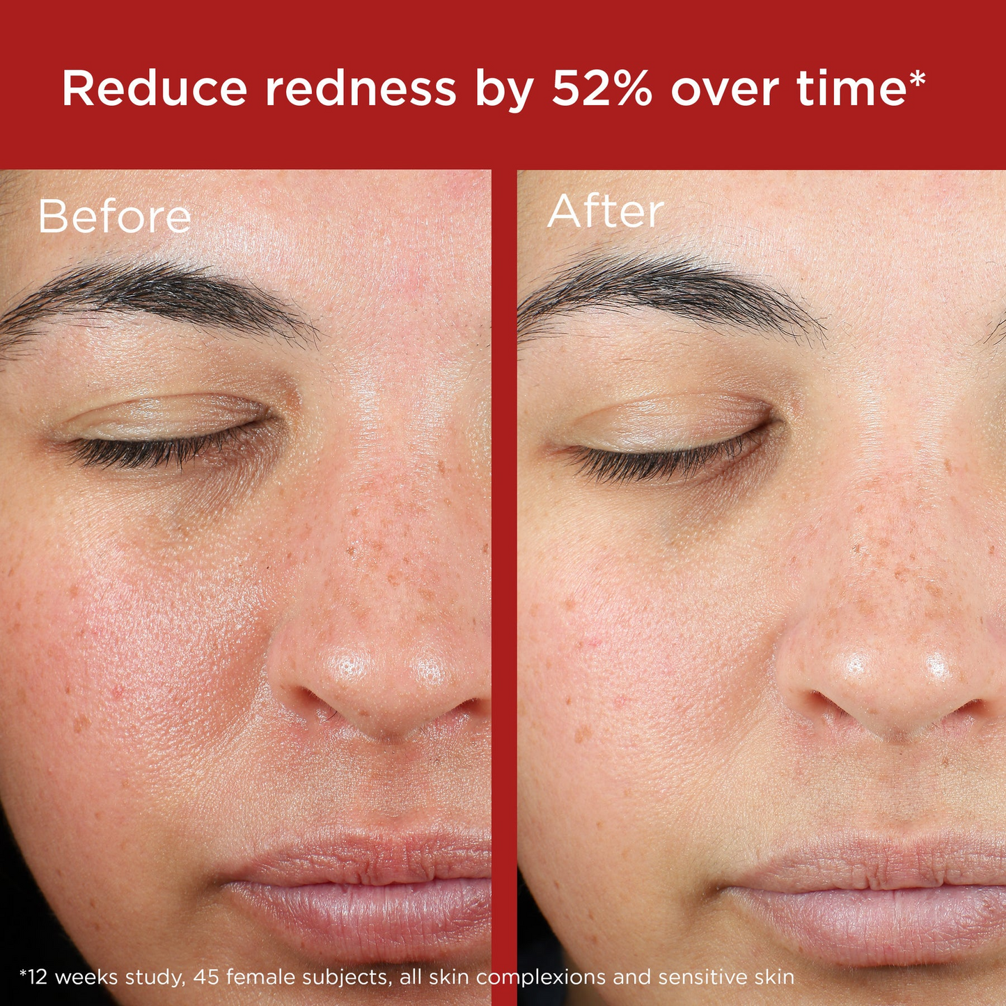 EltaMD UV Skin Recovery Broad Spectrum SPF 50