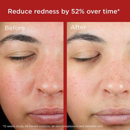 EltaMD UV Skin Recovery Broad Spectrum SPF 50