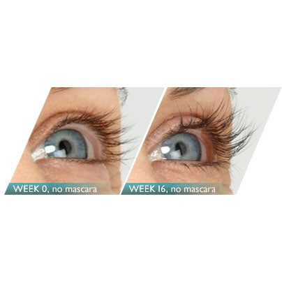 Latisse 5ML