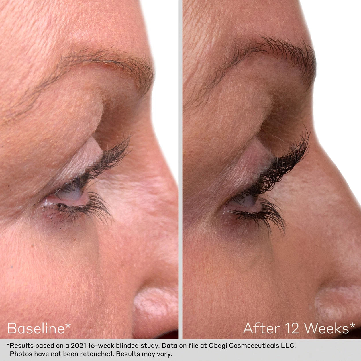 Obagi Nu-Cil Brow & Lash Enhancing Kit
