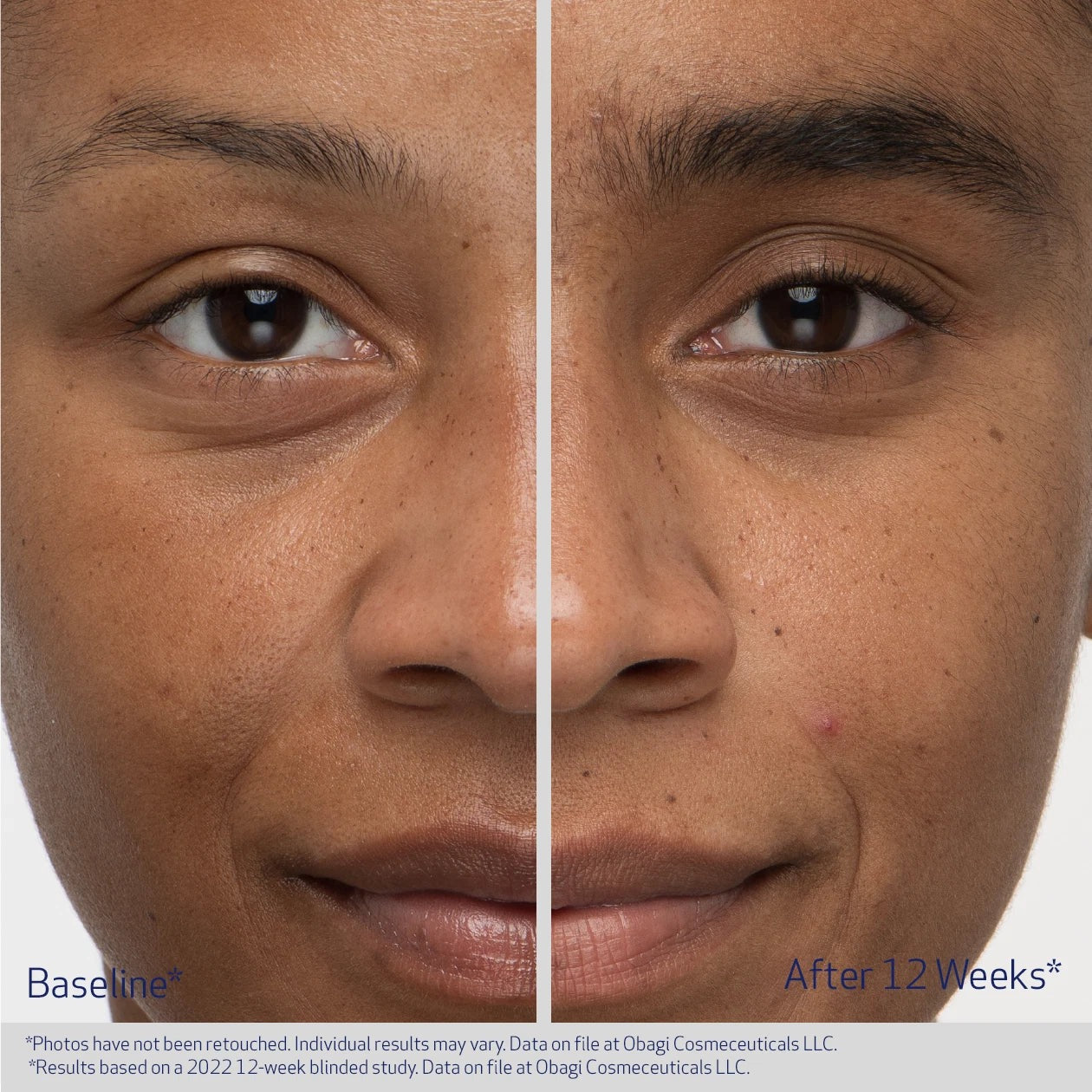 Obagi Eyebrow Serum