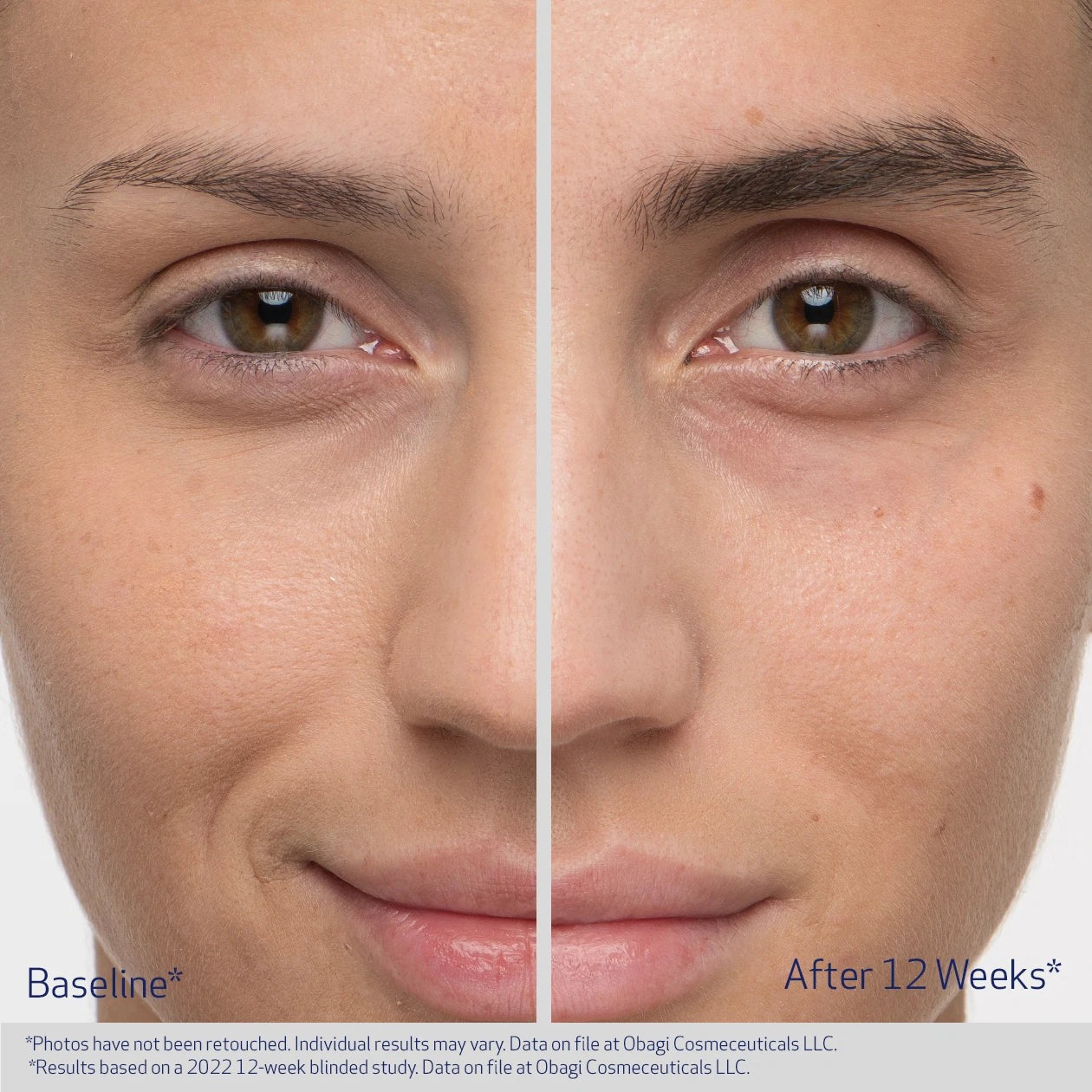 Obagi Eyebrow Serum