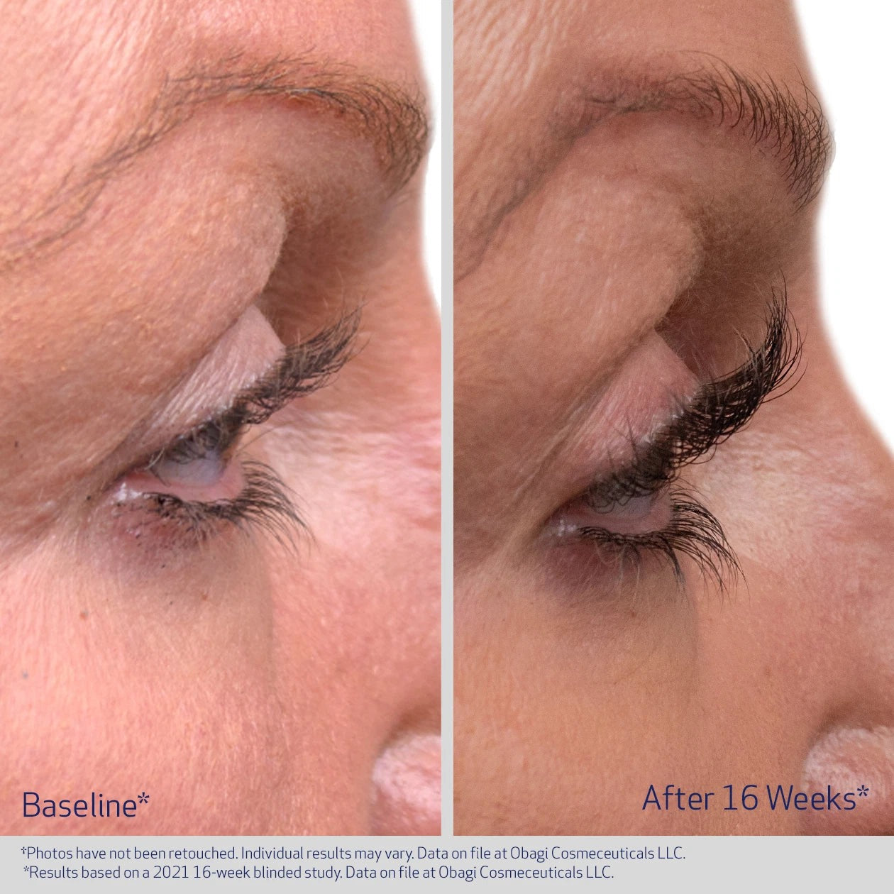 Obagi Eyelash Serum