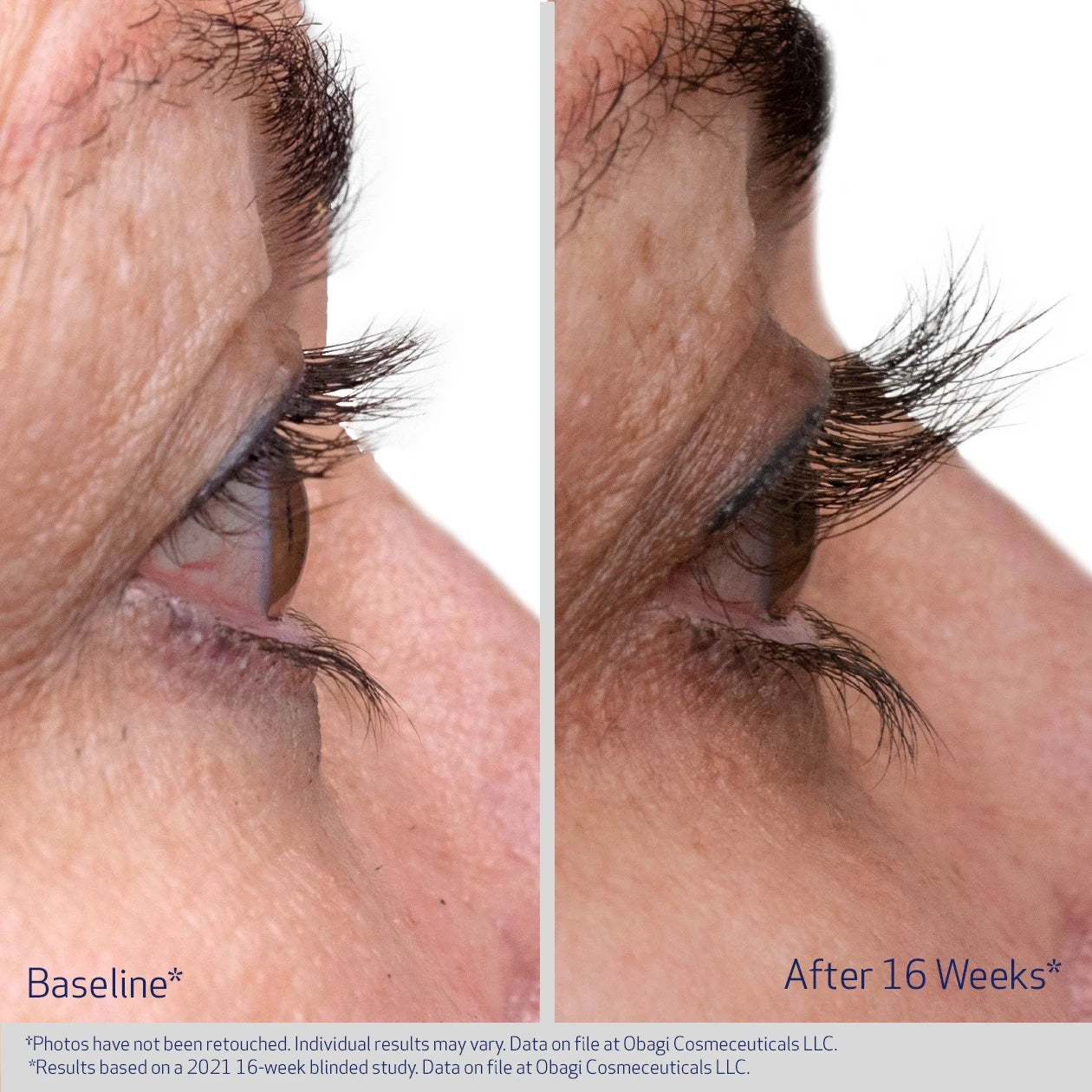 Obagi Eyelash Serum