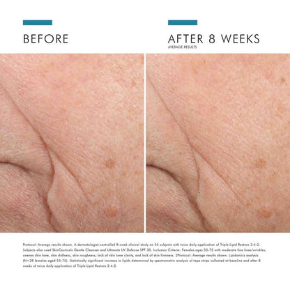Triple Lipid Restore