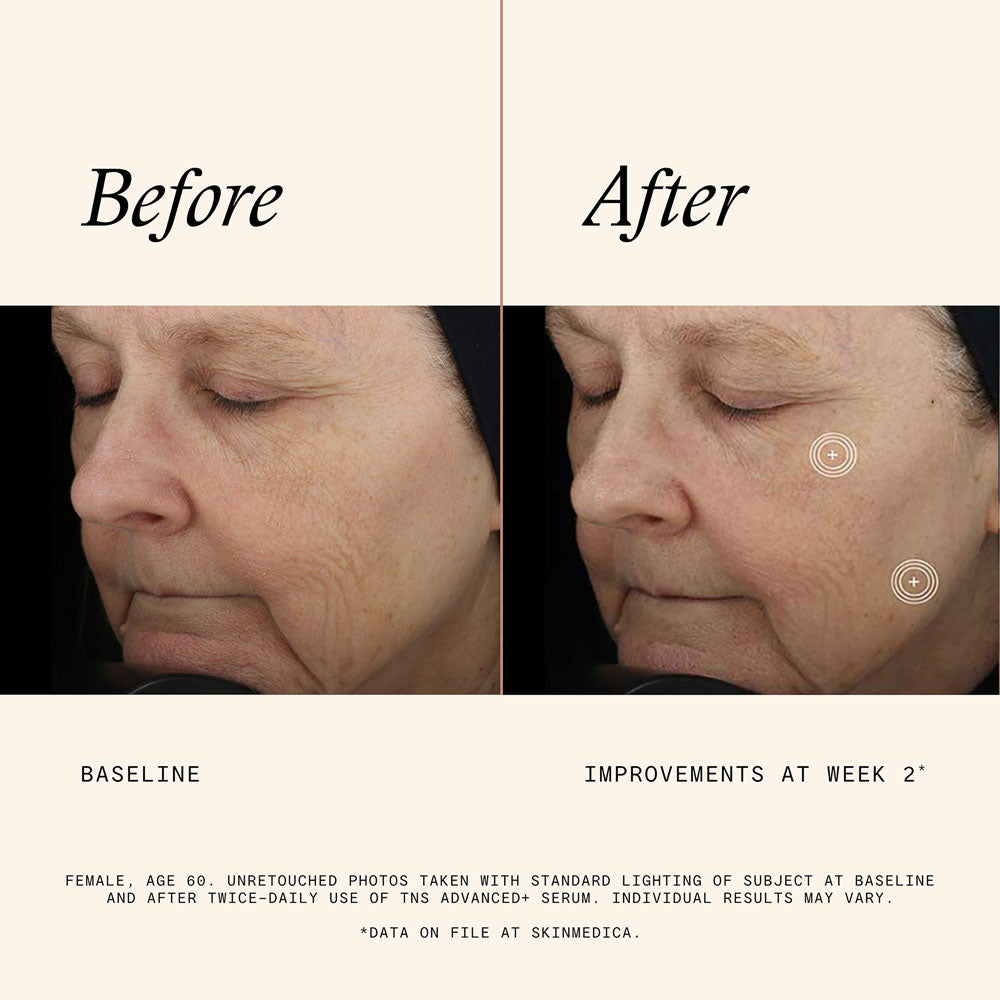 TNS Advanced+ Serum